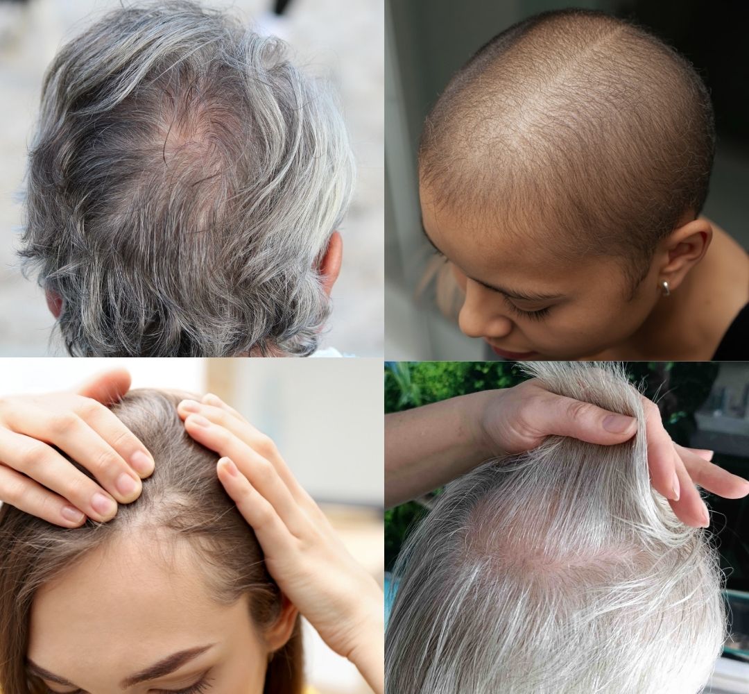 Haarkraft_dünnes Haar